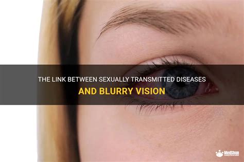 The Link Between Sexually Transmitted Diseases And Blurry Vision Medshun