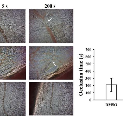 Effect Of Pterostilbene PTE On Vascular Thrombosis In The Mesenteric