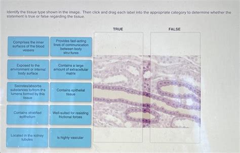 Solved Identify The Tissue Type Shown In The Image Then Chegg