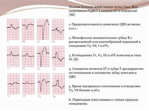 Блокады сердца - презентация онлайн