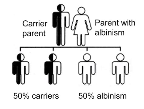 Noah Virtual Conference 2020 Day 3 And 4 Albinism Up Close