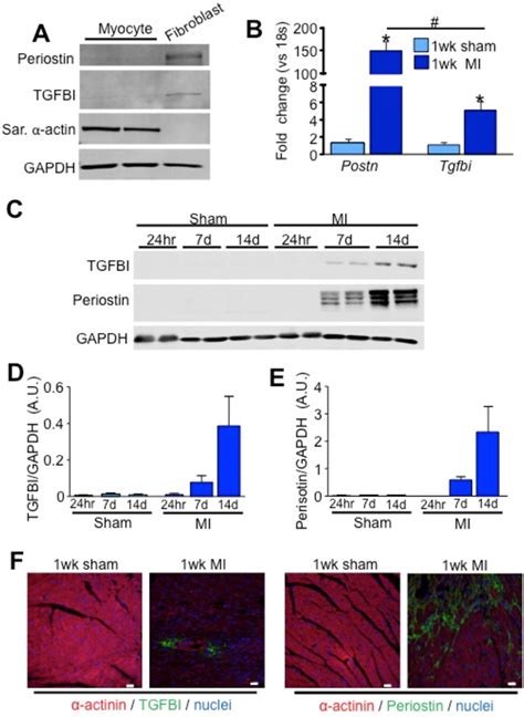 Figure 19 From Dissecting The Roles Of Periostin And TGFBI In