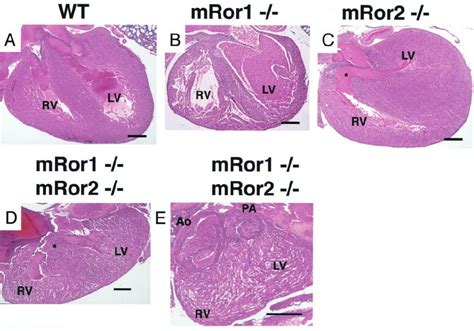 Histological Analysis Of Hematoxylin And Eosin Stained Longitudinal