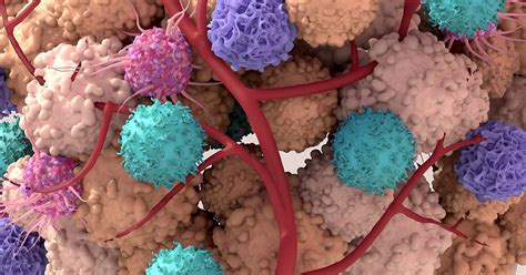 The Tumor Microenvironment And Its Role In Cancer