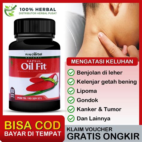 Jual Obat Benjolan Di Leher Bengkak Kelenjar Getah Bening Benjolan