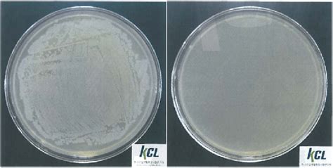 (a) Digital images of cultivated E. coli colonies on agar culture ...