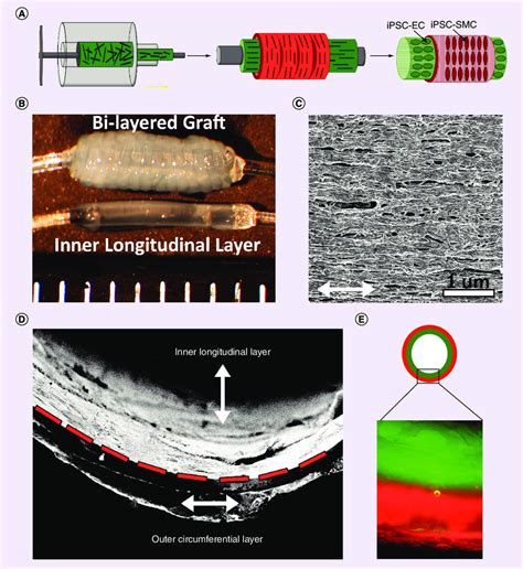 Production Of A Bilayered Aligned Nanofibrillar Collagen Graft