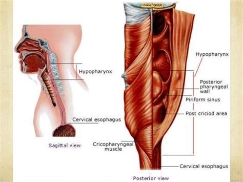 Hypopharyngeal Cancer