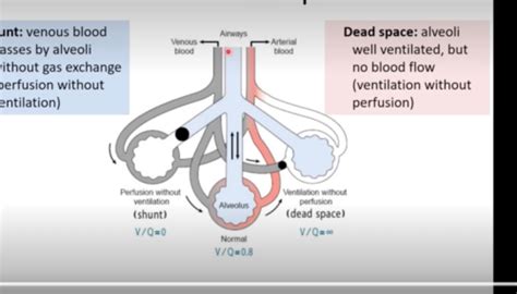 Ventilation Perfusion And Hypoxia Pt 2 Flashcards Quizlet