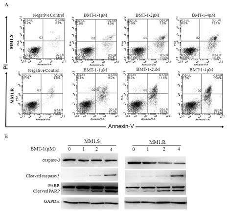 Benzimidazole derivative, BMT-1, induces apoptosis in multiple myeloma ...