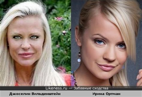 Джоселин Вильденштейн до операций похожа на Ирину Ортман :: Забавные ...