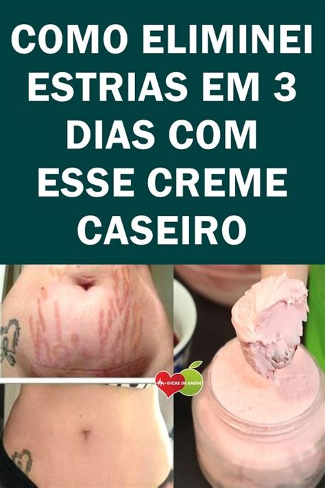 As Receitas Caseiras Para Eliminar As Estrias Rapidamente Make