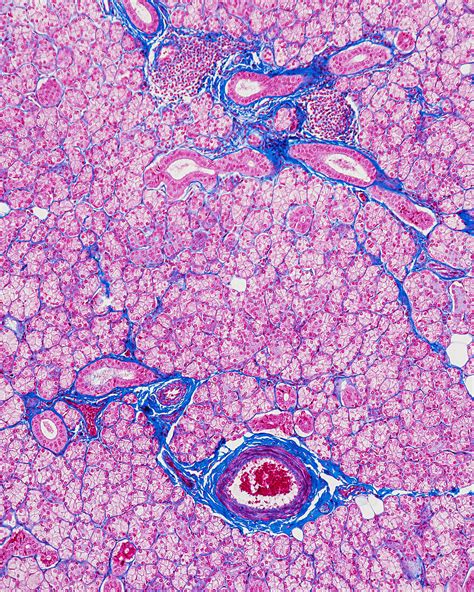 Salivary Gland Light Micrograph Bild Kaufen 13505081 Science Photo