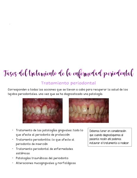 SOLUTION Preclinico Fases Del Tratamiento De La Enfermedad Periodontal