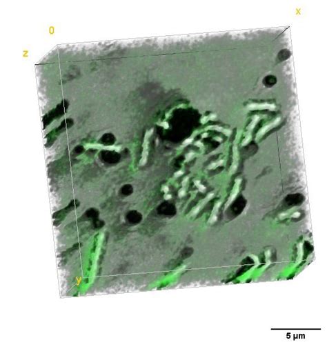 Ijms Free Full Text The Enhancement Of Antimicrobial Photodynamic Therapy Of Escherichia