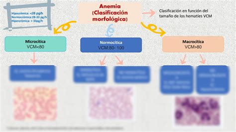 Solution Tipos De Anemia Oms Studypool