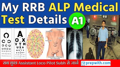 My Rrb Alp Medical Test Details मेरा Medical Test कैसे हुआ Railway