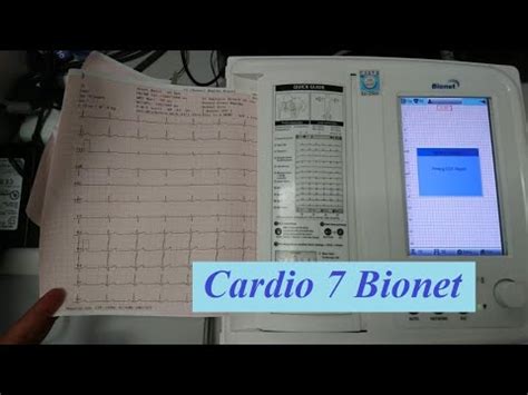 Cardio 7 Bionet Cardiography Kiểm tra và test máy điện tim 12 kênh