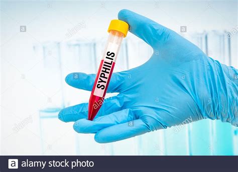 Sick With Syphilis Hi Res Stock Photography And Images Alamy