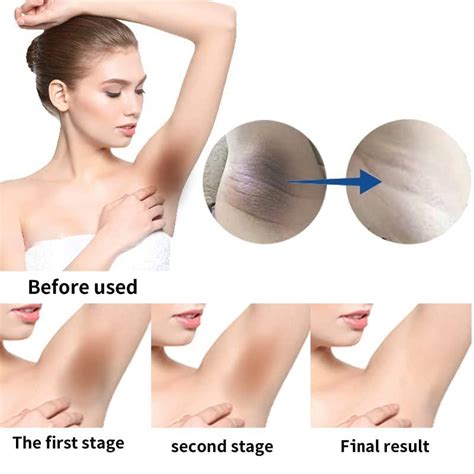 Skin Lightening Cream For Underarms Knees Elbows Thighs Bikini Line USA Made Permanent