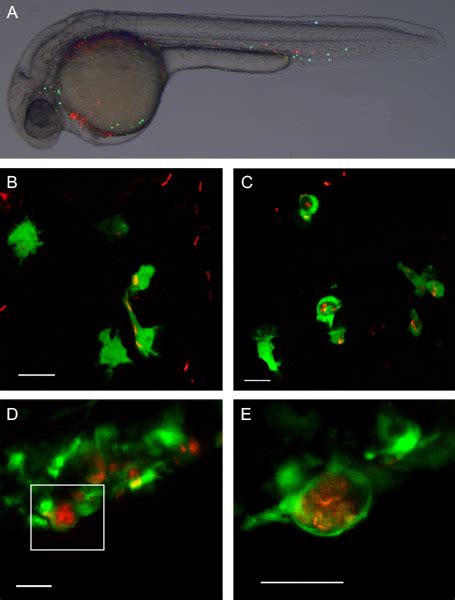 Infection Of Zebrafish Embryos With Intracellular Bacterial Pathogens