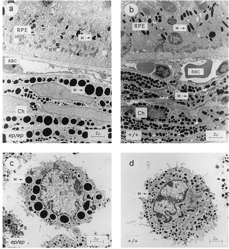 Ultrastructure of eye tissue and cultured skin melanocytes from C57BL6J... | Download Scientific ...