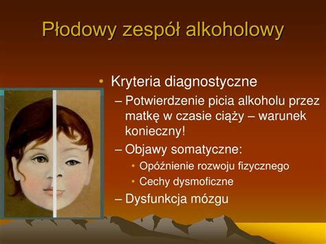 Ppt Infekcje Wewn Trzmaciczne Teratogeny Powerpoint Presentation