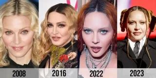 Madonna Underwent Facelift Surgery Plastic Surgery Journey Bizrahmed