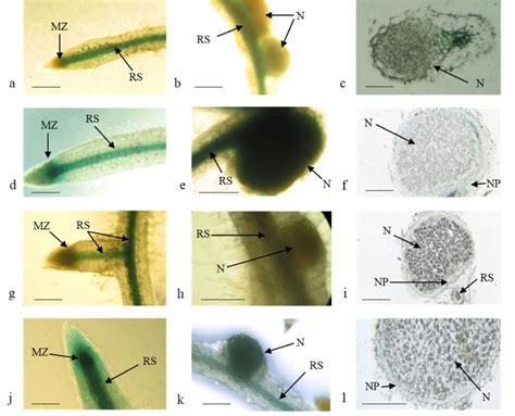 Histochemical Localization Of Glucuronidase Gus Activity In Roots