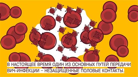 Риск заражения ВИЧ - YouTube
