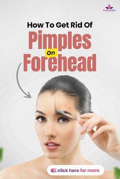 How To Get Rid Of Pimples On The Forehead?