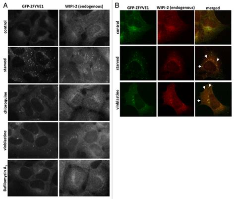 Full Article Characteristics And Requirements Of Basal Autophagy In