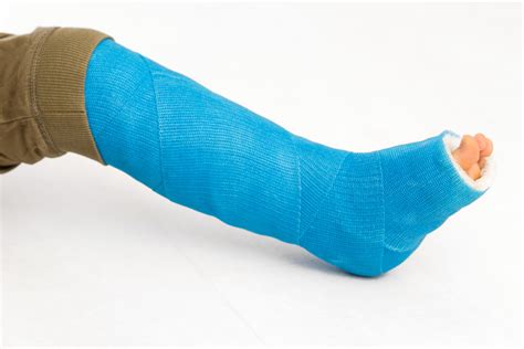 How Can I Speed Up Healing a Broken Bone? - Countryside Orthopaedics