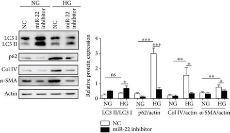 MiR 22 inhibited autophagy and mediated HG induced Col IV and α SMA