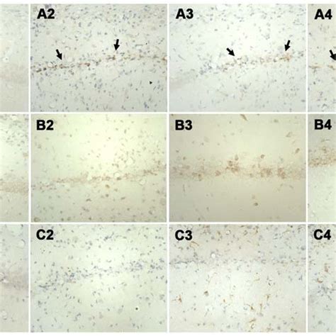Immunohistochemical staining of the CA1 region of the hippocampus ... 