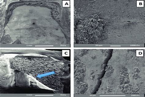 Sem Images Of Premolar Enamel Surfaces Etched With Sep And De Bracketed