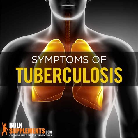 Tuberculosis (TB) Symptoms & Treatment