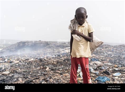 Malnourished Africa Child Hi Res Stock Photography And Images Alamy