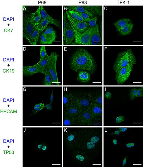 Immunofluorescence Staining Of Patient Derived Cell Lines CK7 A C