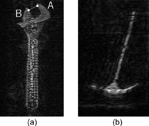 Figure From Precise D And D Fluoroscopic Imaging By Using An Fmcw