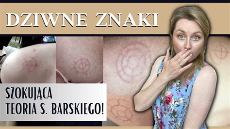 DZIWNE ZNAKI na ciele w kształcie steru teoria S Barskiego YouTube