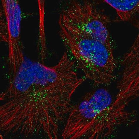 Anti SNX1 Antibody Produced In Rabbit