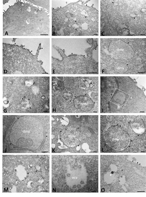 Immuno Electron Microscopy Showing Ace Localization In Mock Infected