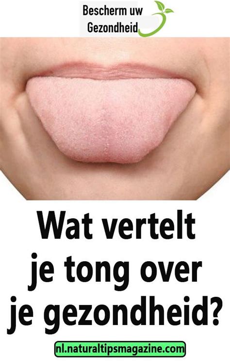 Wat Vertelt Je Tong Over Je Gezondheid Gezondheid En Welzijn Gezond