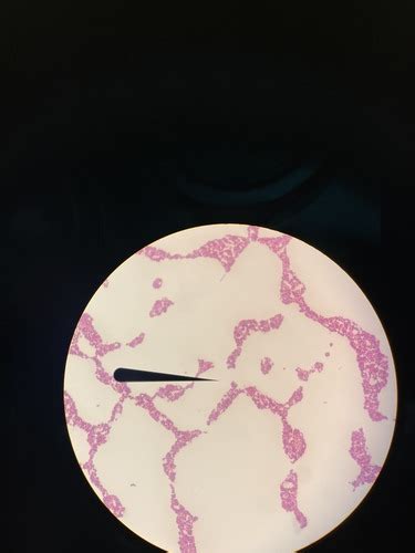 Medical Micro Lab 2 Pictures Flashcards Quizlet