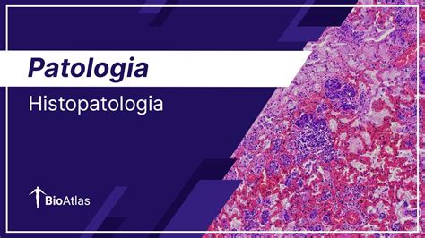 Histopatologia Patologia Bioatlas Youtube