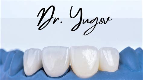 Препарирование зуба под полную коронку. Tooth preparation for a full ...