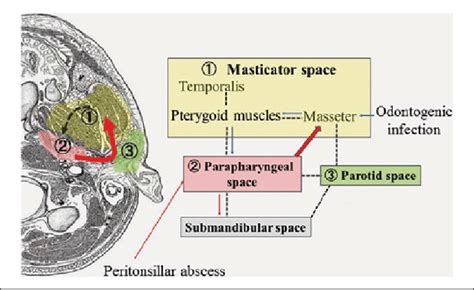 Anatomy Of The Masticator Space And Adjacent Or Communicating Download Scientific Diagram