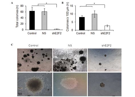 RNAimediated Knockdown Of E2F2 Inhibits Tumorigenicity Of Human