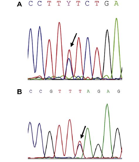 A Sequence Analysis Of Ctnnb D Showing Heterozygosity For The